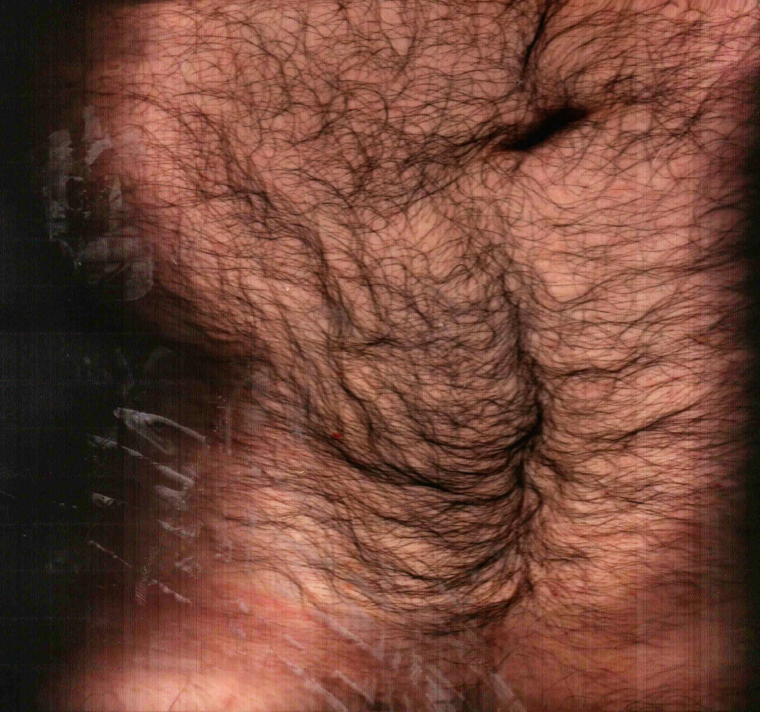 Superficie Umana – scanner photography e pittura, corpo come frammento e traccia, mixed media di Matteo Groppi