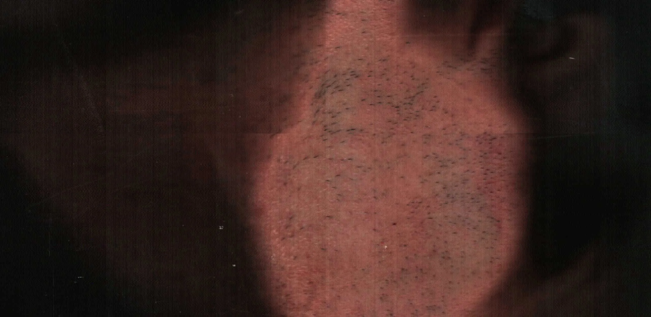 Superficie Umana #10