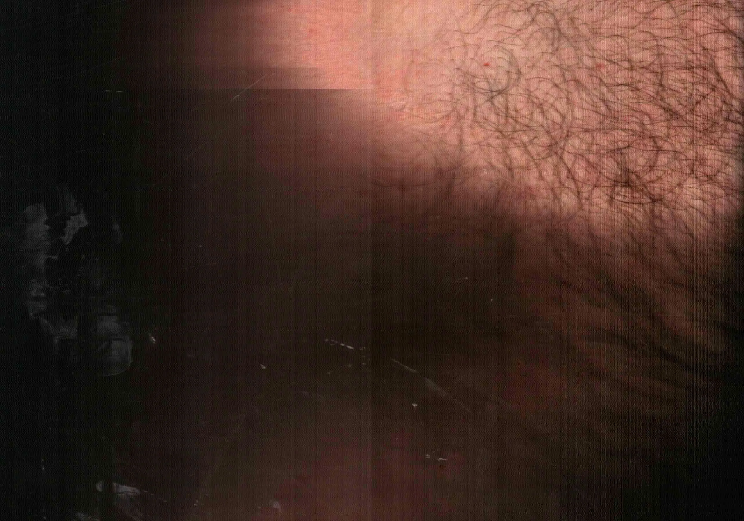 Superficie Umana #12