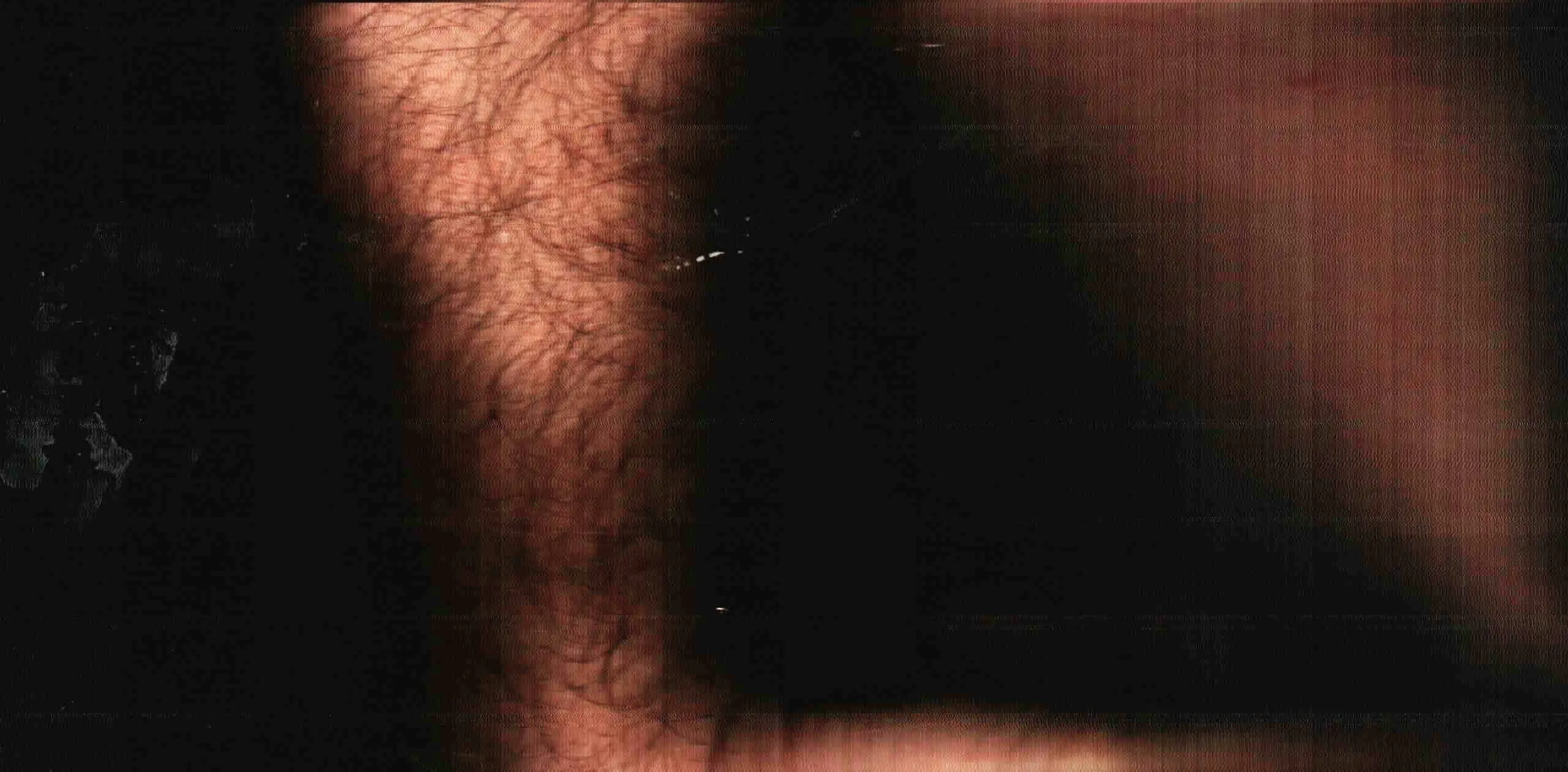 Superficie Umana #13